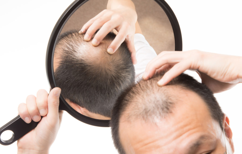 アミノ酸が発毛に効果的な理由とは？ケラチンとの関係性も解説！