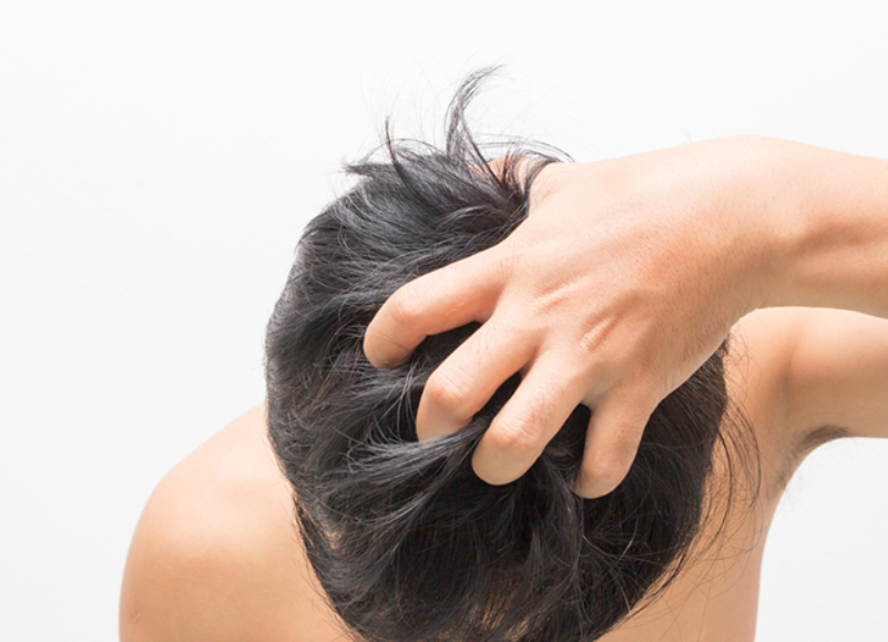 発毛・育毛に効果的な睡眠方法3選