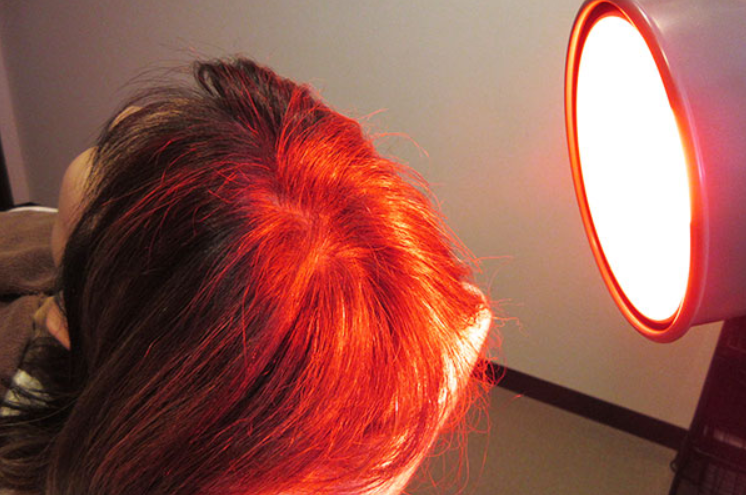 さいごに｜発毛の新技術「赤色LED」は期待大！