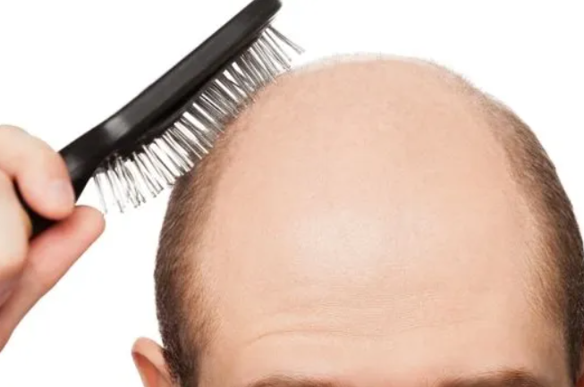 【結論】頭皮を叩くと発毛するのはウソ！その理由と発毛のメカニズムを解説！