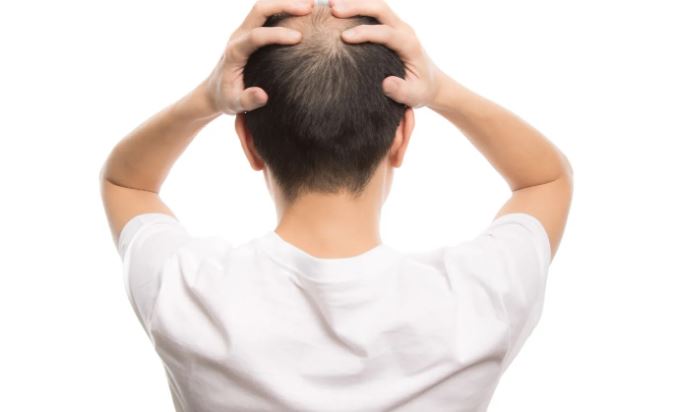 頭皮ニキビを改善して発毛への影響を抑えよう！効果的な方法3選