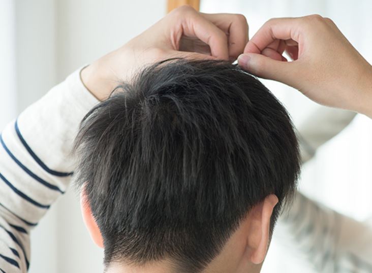 発毛対策をしたい方必見！頭皮の保湿が重要な理由とは？